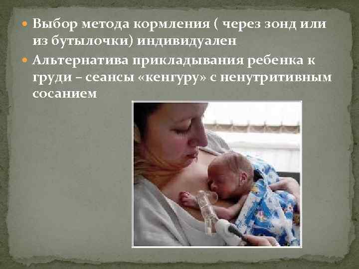  Выбор метода кормления ( через зонд или из бутылочки) индивидуален Альтернатива прикладывания ребенка