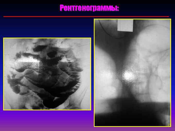 Рентгенограммы:    15 