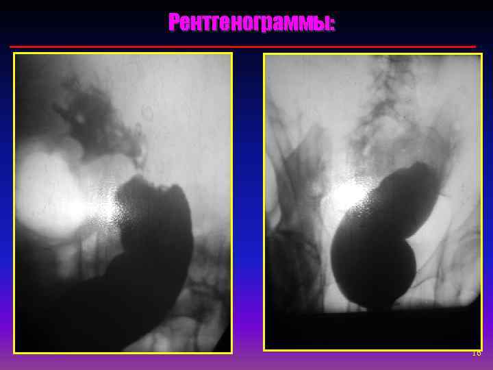 Рентгенограммы:    16 