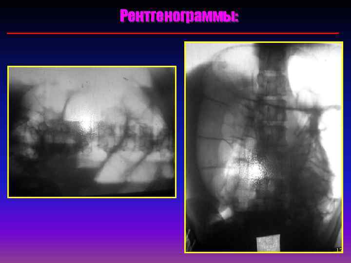 Рентгенограммы:    17 