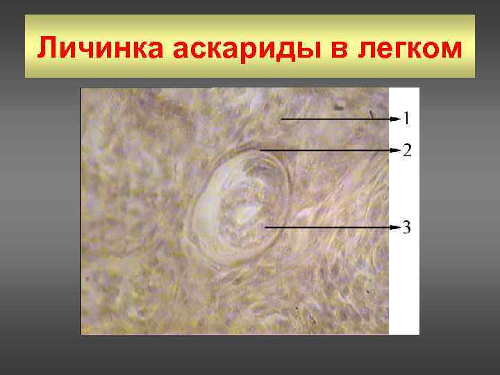 Какой цифрой обозначена на рисунке личинка