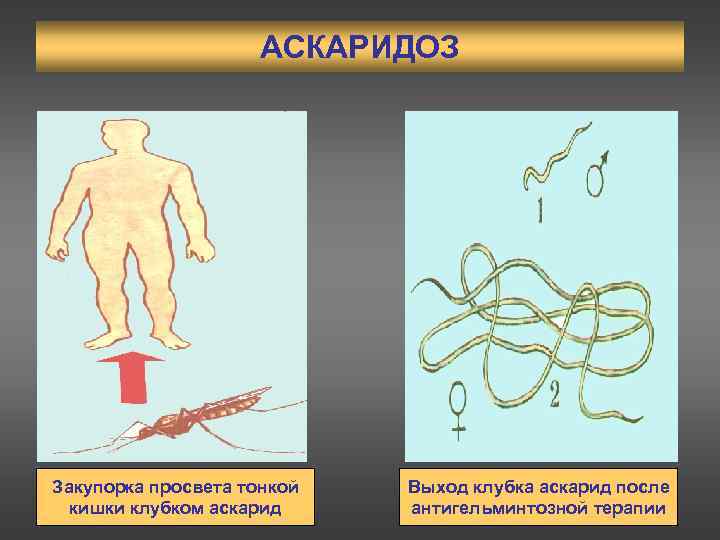 Аскаридоз возбудитель рисунок