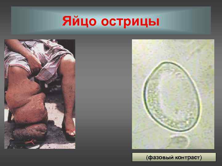 Яйцо острицы    (фазовый контраст) 