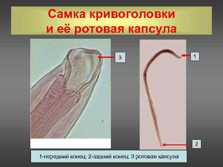  Самка кривоголовки  и её ротовая капсула      3