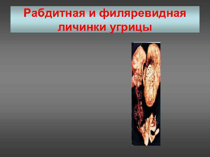 Рабдитная и филяревидная личинки угрицы 