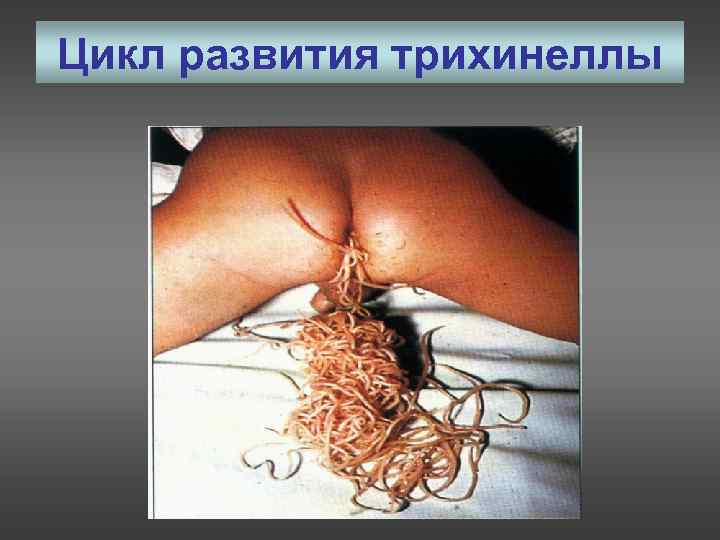 Цикл развития трихинеллы 