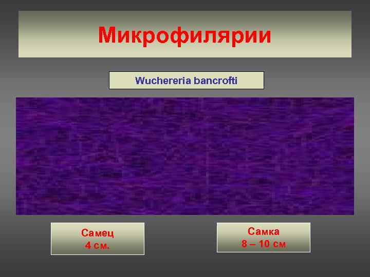   Микрофилярии   Wuchereria bancrofti Самец      Самка