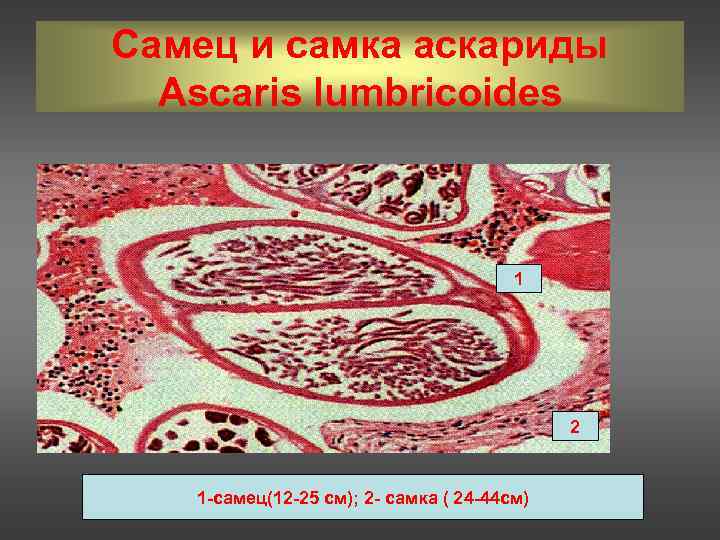 Самец и самка аскариды  Ascaris lumbricoides       1