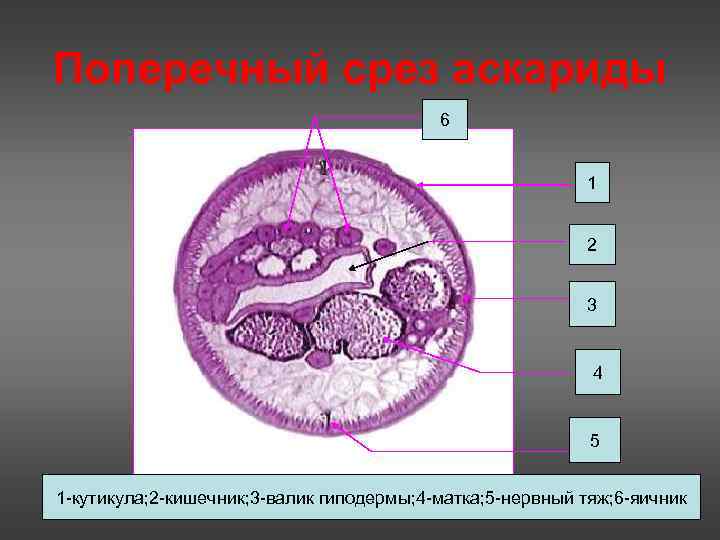 Поперечный срез аскариды    6      1 