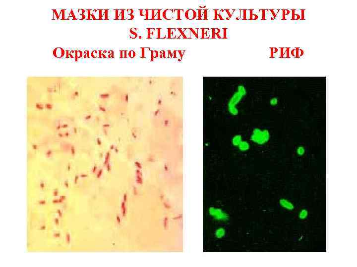 Патогенные шигеллы. Шигеллы микробиология. Морфология шигелл микробиология. Шигелла окраска по Граму. Шигелла мазок из чистой культуры.