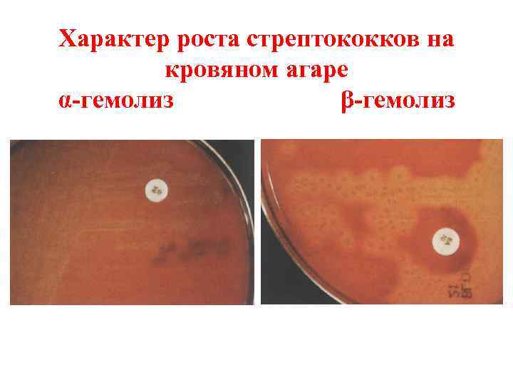 Бактериологическое исследование оки