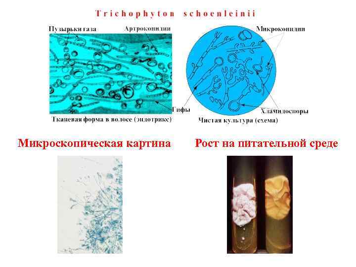Микроскопическая картина Рост на питательной среде 