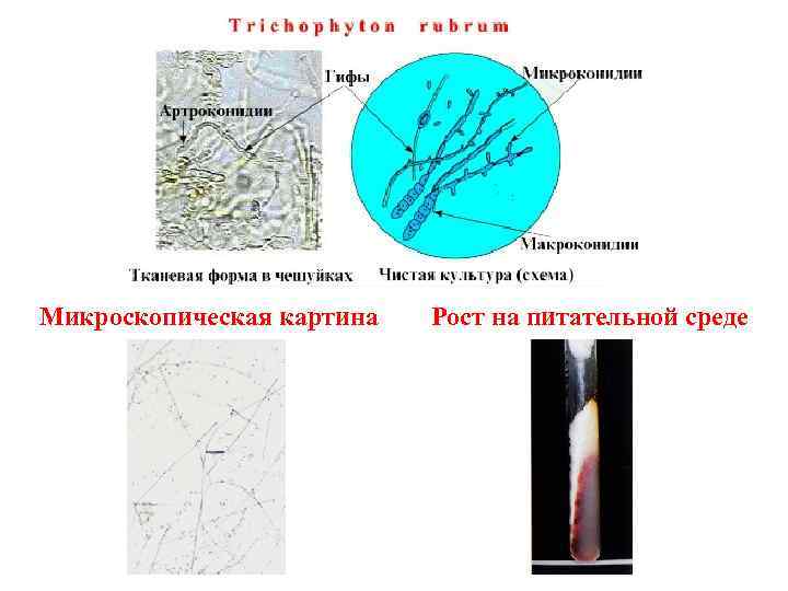 Микроскопическая картина Рост на питательной среде 