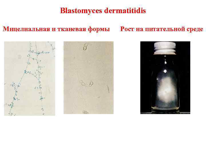 Blastomyces dermatitidis Мицелиальная и тканевая формы Рост на питательной среде 