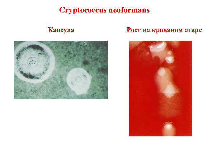 Cryptococcus neoformans Капсула Рост на кровяном агаре 