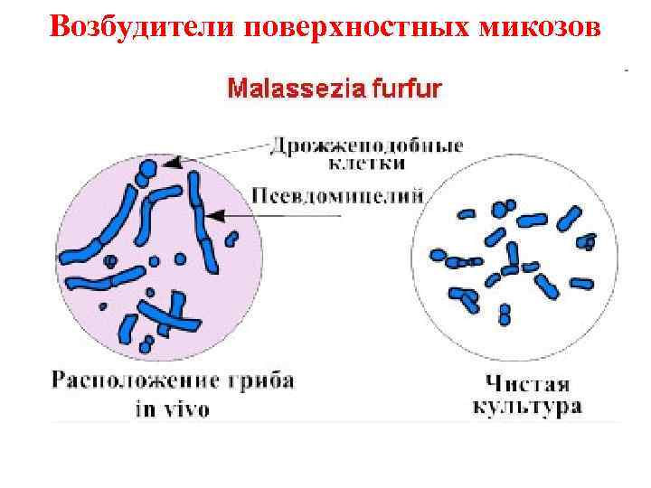 Возбудители поверхностных микозов 