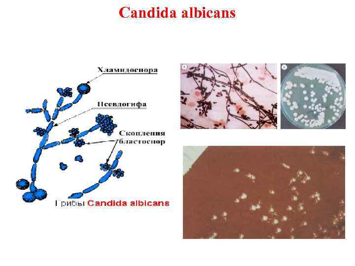 Candida albicans 