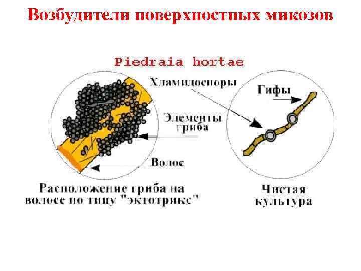 Возбудители поверхностных микозов 