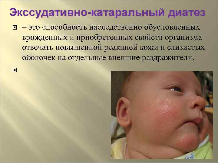 Экссудативно-катаральный диатез – это способность наследственно обусловленных врожденных и приобретенных свойств организма отвечать повышенной