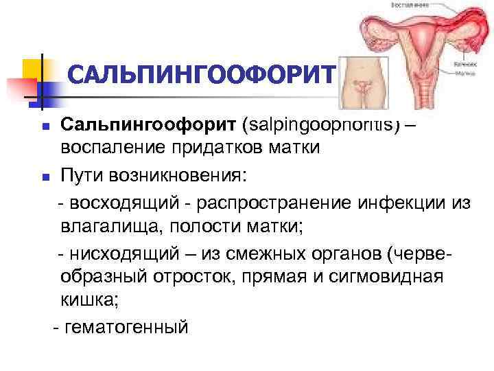   САЛЬПИНГООФОРИТ n Сальпингоофорит (salpingoophoritis) –  воспаление придатков матки n Пути возникновения: