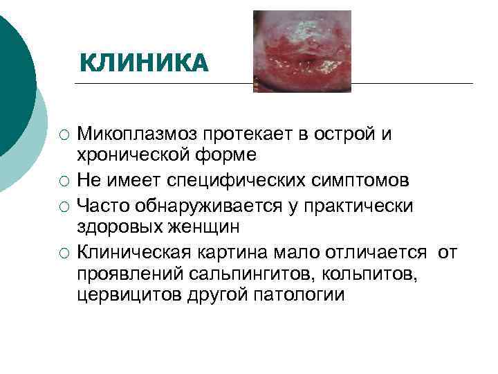   КЛИНИКА ¡  Микоплазмоз протекает в острой и хронической форме ¡ 