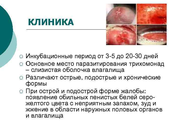   КЛИНИКА  ¡  Инкубационные период от 3 -5 до 20 -30