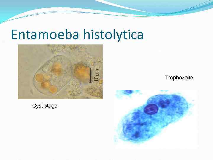 Entamoeba histolytica Trophozoite Cyst stage Entamoeba histolytica Trophozoite Cyst stage