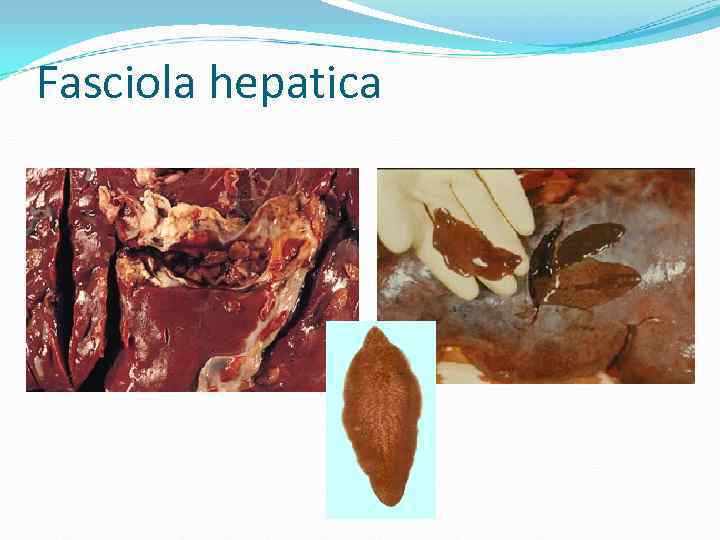 Fasciola hepatica Fasciola hepatica
