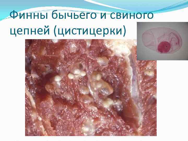 Финны бычьего и свиного цепней (цистицерки) Финны бычьего и свиного цепней (цистицерки)