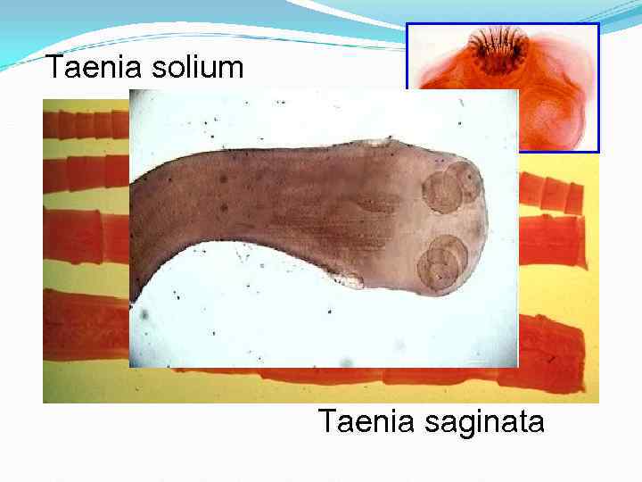 Taenia solium Taenia saginata Taenia solium Taenia saginata