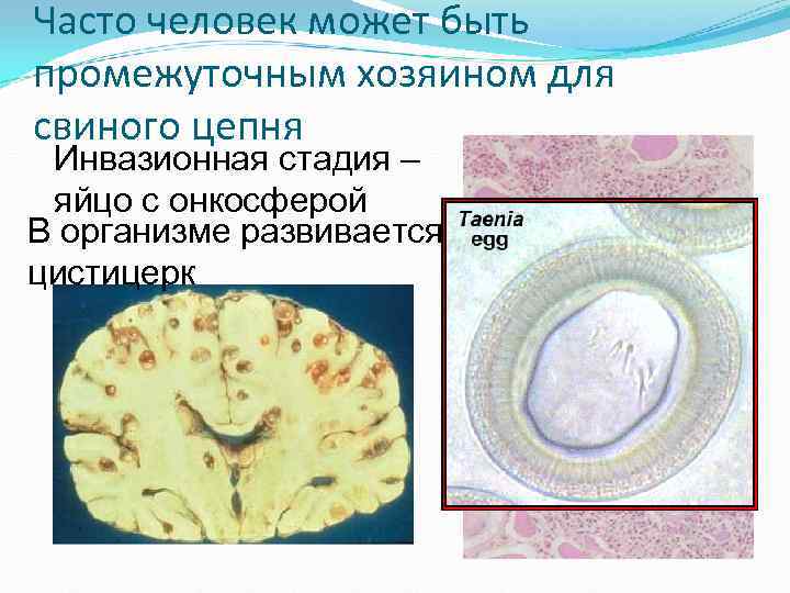 Санитарная паразитология презентация