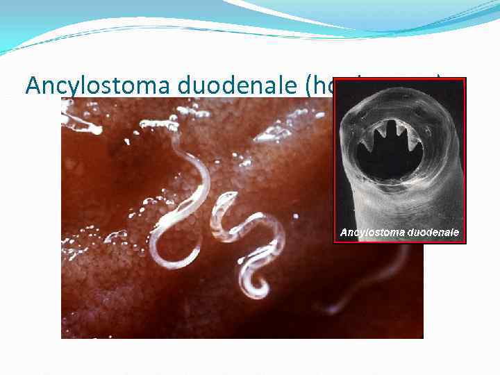 Ancylostoma duodenale (hookworm) Ancylostoma duodenale (hookworm)