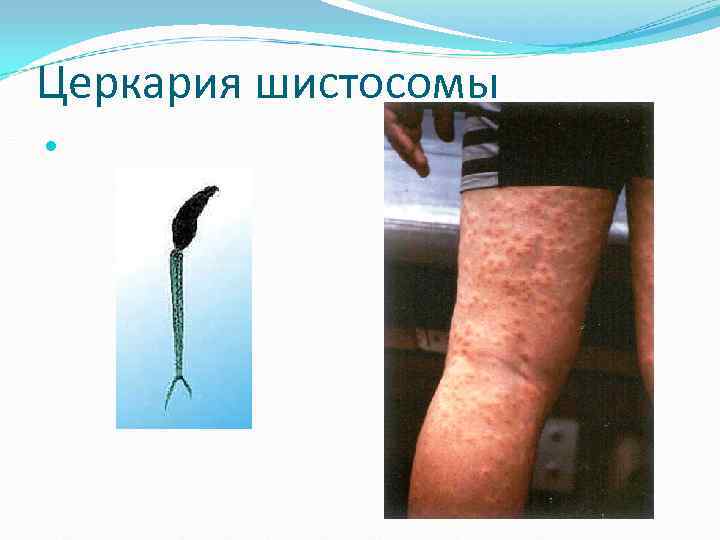 Церкария шистосомы Церкария шистосомы