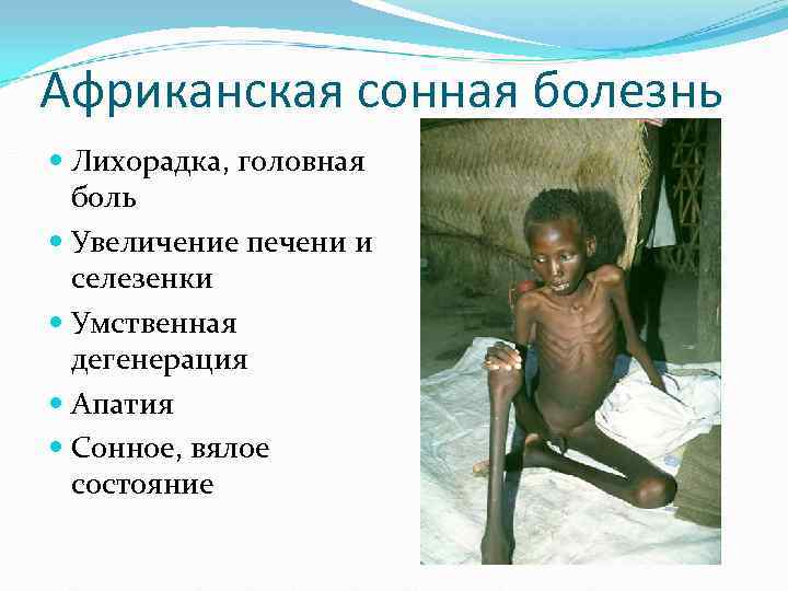 Африканская сонная болезнь Лихорадка, головная боль Увеличение печени и селезенки Африканская сонная болезнь Лихорадка, головная боль Увеличение печени и селезенки