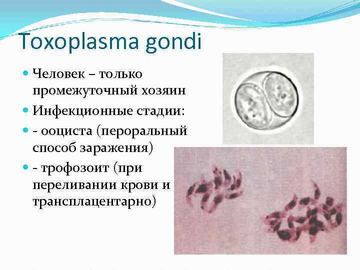 Toxoplasma gondi Человек – только промежуточный хозяин Инфекционные стадии: - ооциста Toxoplasma gondi Человек – только промежуточный хозяин Инфекционные стадии: - ооциста