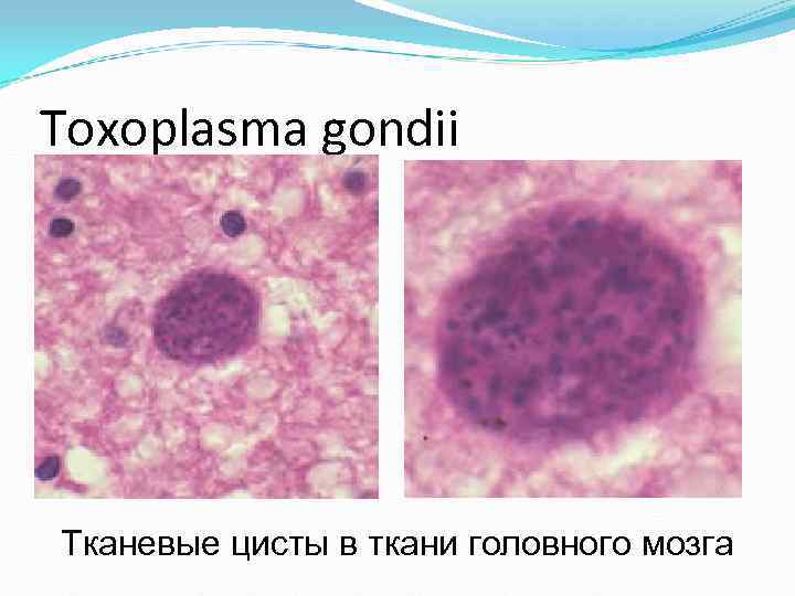 Toxoplasma gondii Тканевые цисты в ткани головного мозга Toxoplasma gondii Тканевые цисты в ткани головного мозга