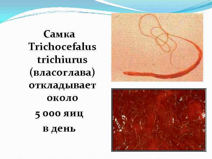 Самка Trichocefalus trichiurus (власоглава) откладывает около 5 000 яиц в Самка Trichocefalus trichiurus (власоглава) откладывает около 5 000 яиц в