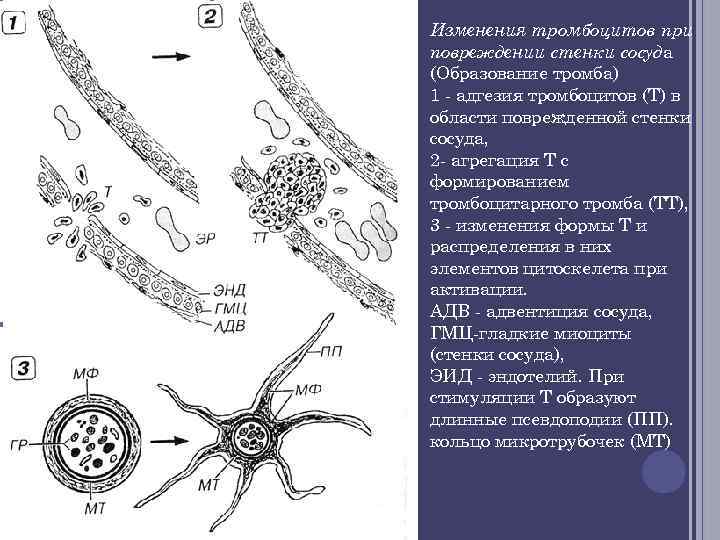 Изменения тромбоцитов при повреждении стенки сосуда (Образование тромба) 1 - адгезия тромбоцитов (Т) в