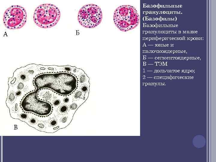 Базофильные гранулоциты. (Базофилы) Базофильные гранулоциты в мазке периферической крови: А — юные и палочкоядерные,