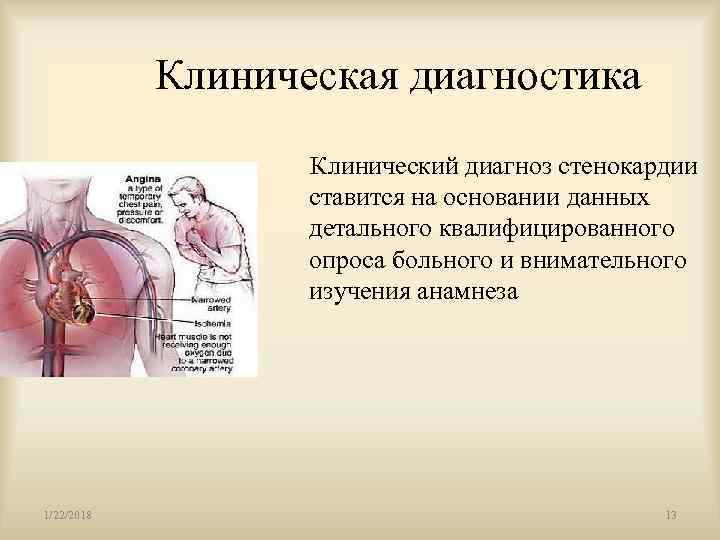   Клиническая диагностика    Клинический диагноз стенокардии    