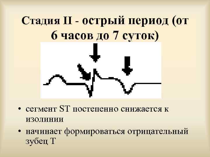 Стадия II - острый период (от 6 часов до 7 суток)  • сегмент
