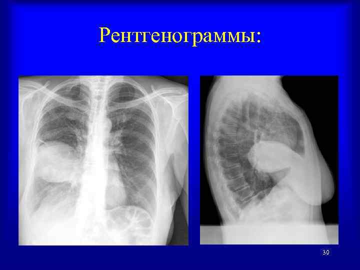 Рентгенограммы: 30 