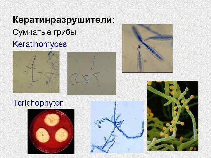 Кератинразрушители: Сумчатые грибы Keratinomyces Tcrichophyton 