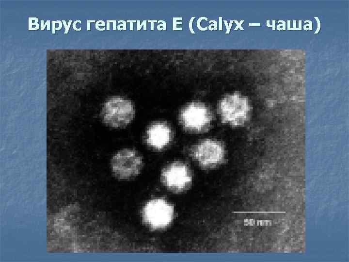 Вирус гепатита Е (Calyx – чаша) 