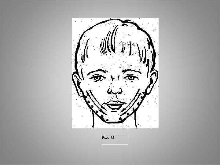 Рис. 22 Рис. 22