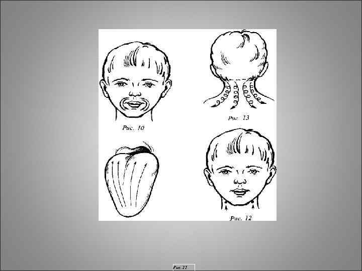 Рис. 11 Рис. 11