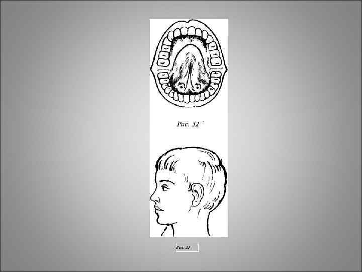 Рис. 33 Рис. 33