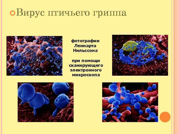  Вирус  птичьего гриппа    фотографии    Леннарта 