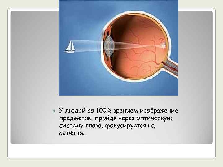   У людей со 100% зрением изображение предметов, пройдя через оптическую систему глаза,
