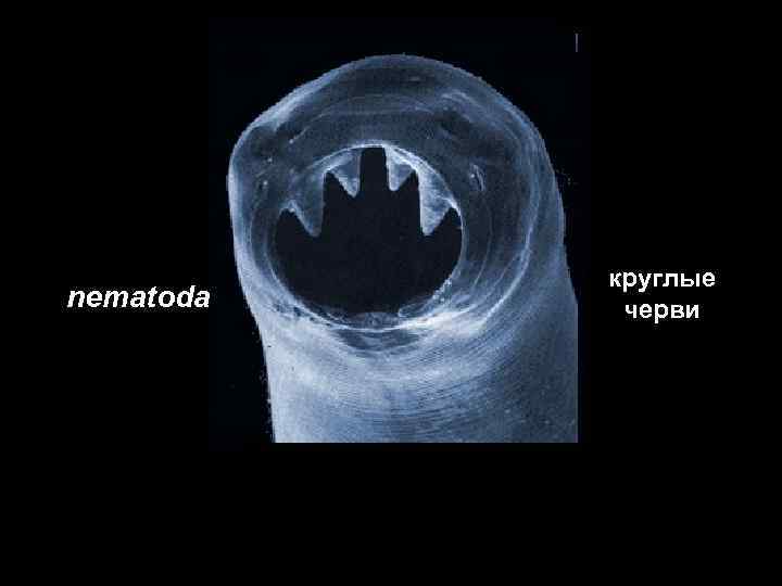   круглые nematoda  черви 